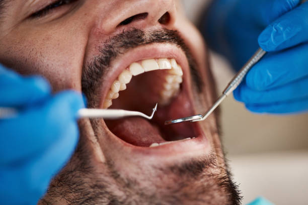 Best Urgent Tooth Repair  in Fearrington Village, NC